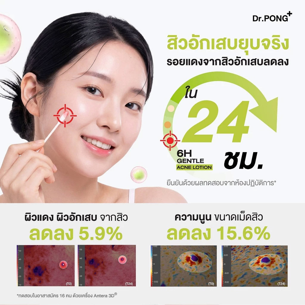 Dr.PONG_6H GENTLE ACNE LOTION_15ml