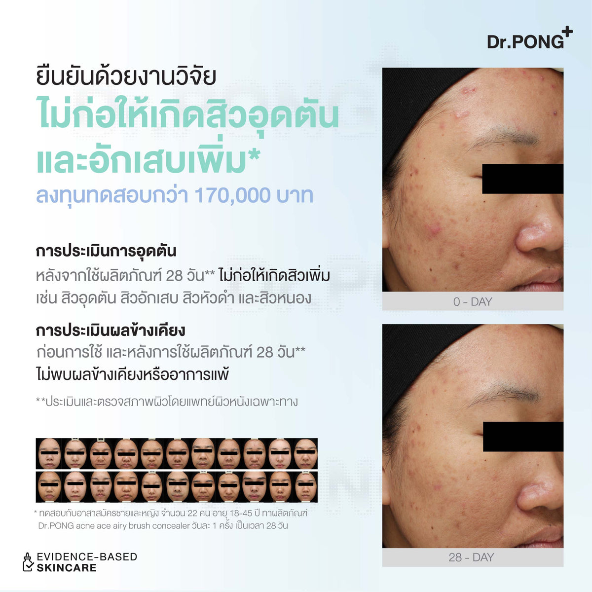 Dr.PONG ACNE ACE AIRY BRUSH CONCEALER คอนซีลเลอร์แต้มสิว กลบรอยสิวเนียนกริบ ไม่อุดตัน มีผลทดสอบงานวิจัย