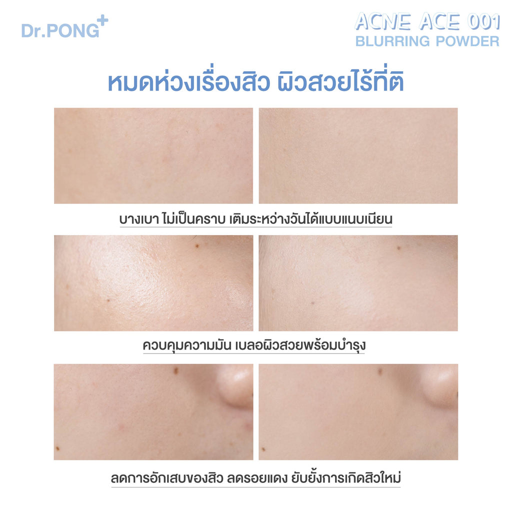 Dr.PONG ACNE ACE 001 Gen 2.0  แป้งไม่ผสมรองพื้น สูตรลดสิว