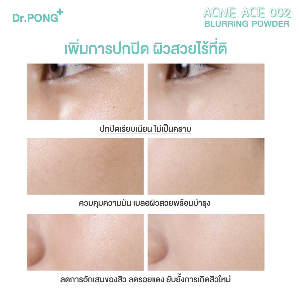 Dr.PONG ACNE ACE 002 แป้งผสมรองพื้น สูตรลดสิว - ZincPCA - Niacinamide - Tranexamic acid - Tea Tree oil
