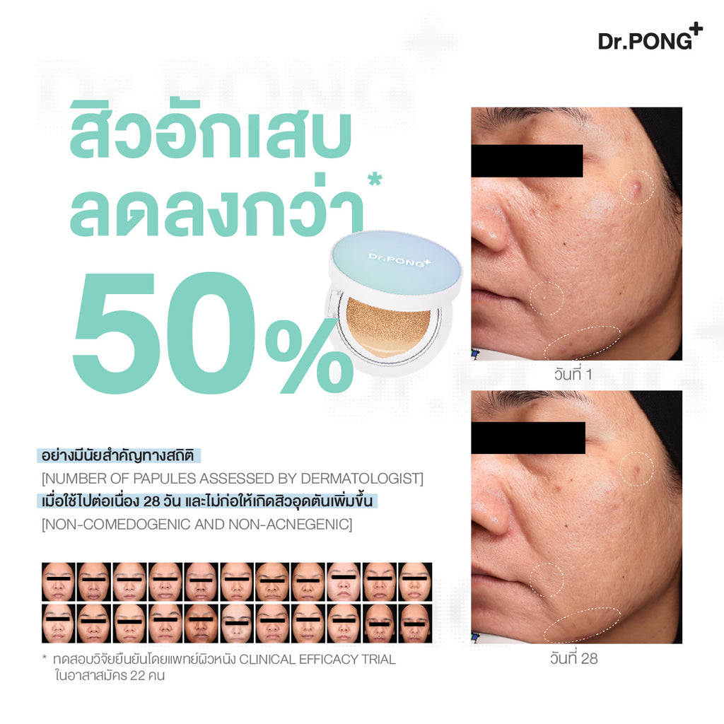 Dr.PONG_ACNE ACE LONGWEAR CUSHION_No.1.5_15g