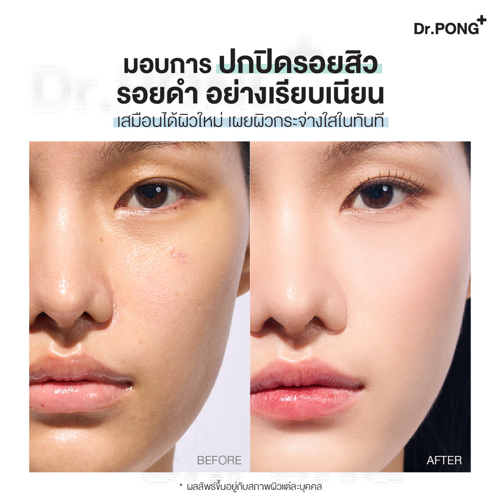 Dr.PONG_ACNE ACE LONGWEAR CUSHION_No.1.5_15g