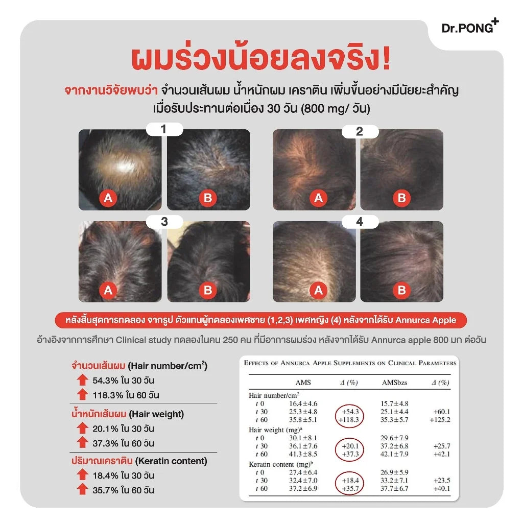 Dr.PONG ANA-X 30 ดอกเตอร์พงศ์ เอเอ็นเอ-เอ็กซ์ 30 วิตามินลดผมร่วง