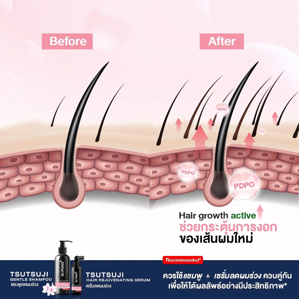 Dr.PONG TSUTSUJI HAIR REJUVENATING SERUM - anti-hairloss serum เซรั่มบำรุงผม ลดผมร่วง